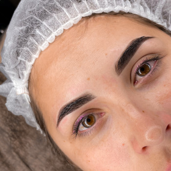 Одразу після процедури