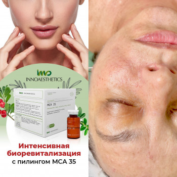 Химические пилинги
                    Косметолог-ін'єкціоніст Ирина Херсон