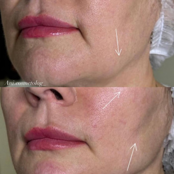 Аніта Сергіївна, Одеса Фото - 15