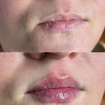 Аніта Сергіївна, Одеса Фото - 16