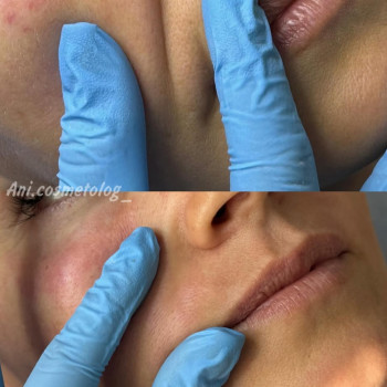 Аніта Сергіївна, Одеса Фото - 17