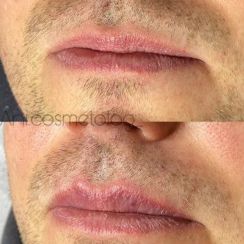 Аніта Сергіївна, Одеса Фото - 19