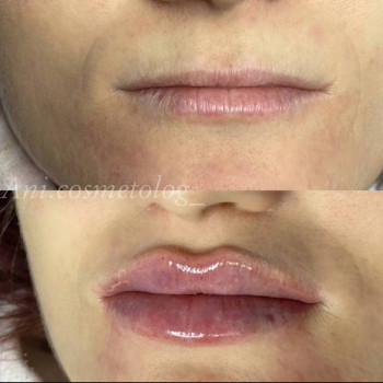 Аніта Сергіївна, Одеса Фото - 24