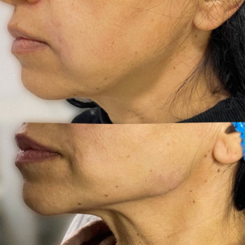 Аніта Сергіївна, Одеса Фото - 25