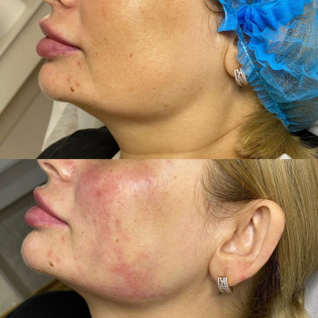 Аніта Сергіївна, Одеса Фото - 26