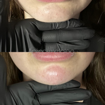 Аніта Сергіївна, Одеса Фото - 31