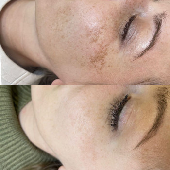 Аніта Сергіївна, Одеса Фото - 33