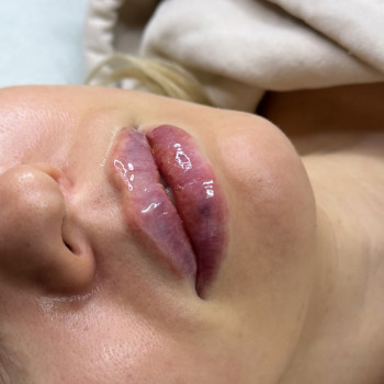 Аніта Сергіївна, Одеса Фото - 40