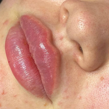 Аніта Сергіївна, Одеса Фото - 11