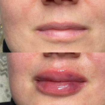 Аніта Сергіївна, Одеса Фото - 12