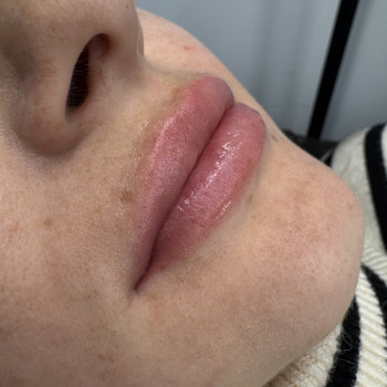 Перманент губ після процедури