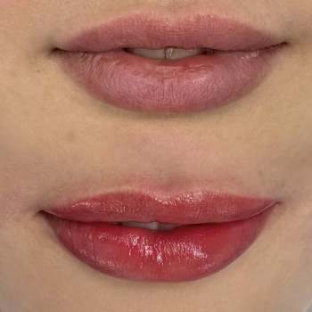 Анастасія Берник, Чернівці Фото - 6