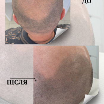 Анастасія Берник, Чернівці Фото - 7