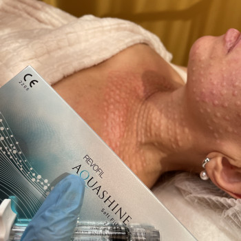 Комплексна робота з обличчям та шиєю


   