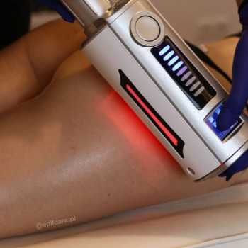 Коригування фігури, прибирання целюліту - ендосфера