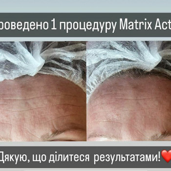 Карбоксітерапія
                    Косметолог Мар'яна Трускавец