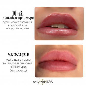 Наталья Якубовская, Черновцы Фото - 22