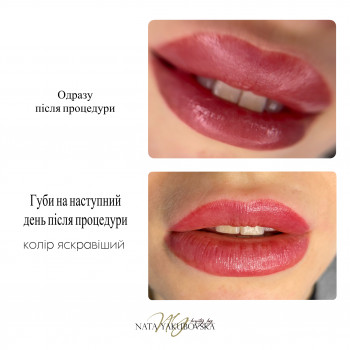 Наталья Якубовская, Черновцы Фото - 24