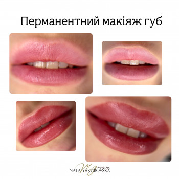 Наталья Якубовская, Черновцы Фото - 25