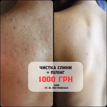 Perfect Skin