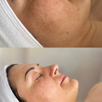 Масаж обличчя
                    Преподаватель курсов красоты Інна Каменец-Подольский