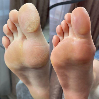 Надія Сташкевич, Українка Фото - 25