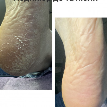 Надія Сташкевич, Українка Фото - 35