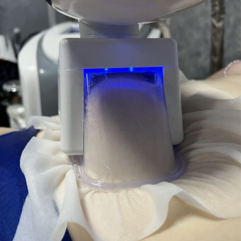 Кріоліполіз масаж з заморозкою жирової тканини
                    Реабілітолог Юлия Київ