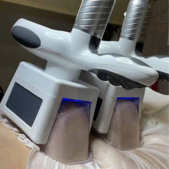 Кріоліполіз масаж з заморозкою жирової тканини
                    Реабілітолог Юлия Київ