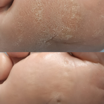 Инна Шахман, Днепр Фото - 6