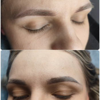 Видалення неякісного татуажу
                    Бровіст Вікторія Рівне