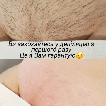  #депіляціявінниця
 #гладкетіло
 #видаленняволосся