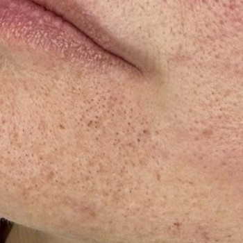 Валерия Бобух, Полтава Фото - 5