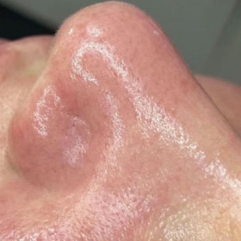 Валерия Бобух, Полтава Фото - 8