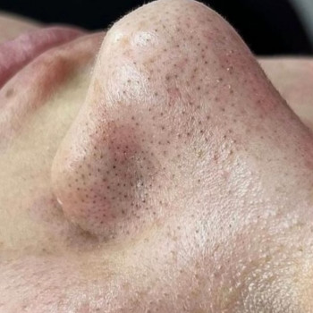 Валерия Бобух, Полтава Фото - 9