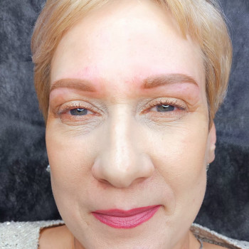 После первичной процедуры