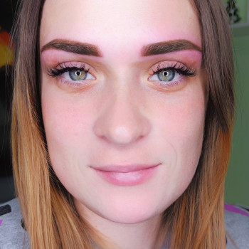 После первичной процедуры