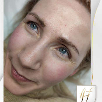 Перманентний макіяж брів: після процедури (фото №2)

   