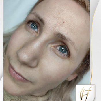 Фото №2: до процедури.
Перманентний макіяж брів: до процедури (фото №2)

   
 