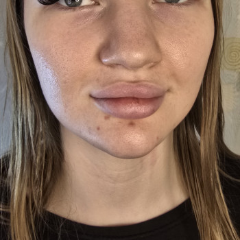 Нарощення вій
                    Салон краси Beauty for you Київ