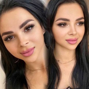 Аліна Ланько, Черновцы Фото - 7