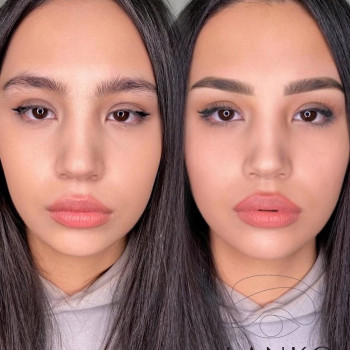 Аліна Ланько, Черновцы Фото - 8