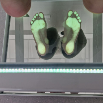 пласка стопа