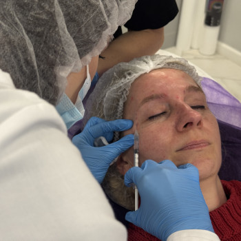 Ботулінотерапія