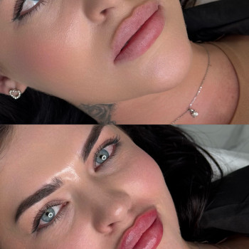 Контурна пластика губ