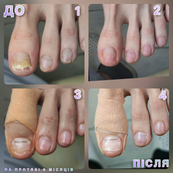 Щекотливая тема, Одесса Фото - 4