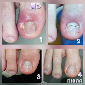 Щекотливая тема, Одесса Фото - 5