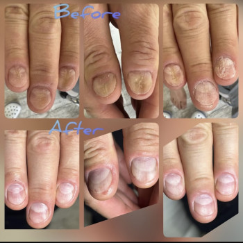 Щекотливая тема, Одесса Фото - 6