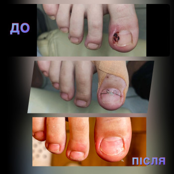 Щекотливая тема, Одесса Фото - 12