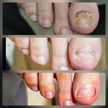 Щекотливая тема, Одесса Фото - 14